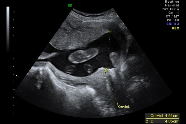 Second Trimester: The Best and Worst Weeks